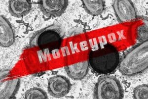 mpox outbreak global health emergency