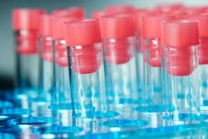 Qdi Quest Diagnostics